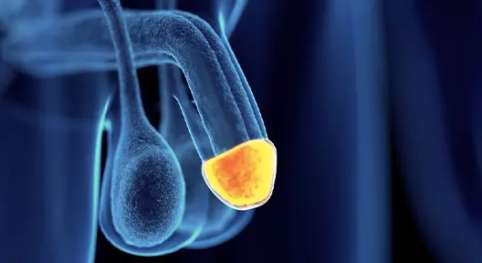 Dolgu-Enjeksiyonu-ile-Penis-Basi-Glans-Buyutulmesi-nasil-yapilir