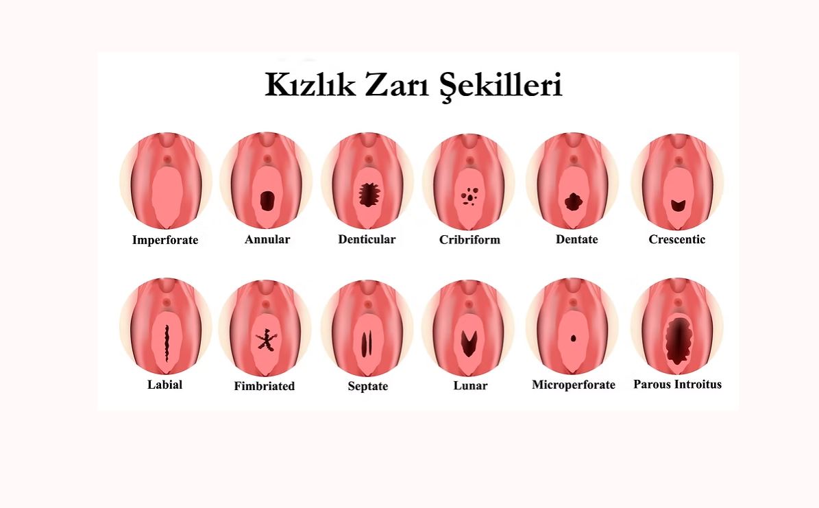 kizlik-zari-dikimi